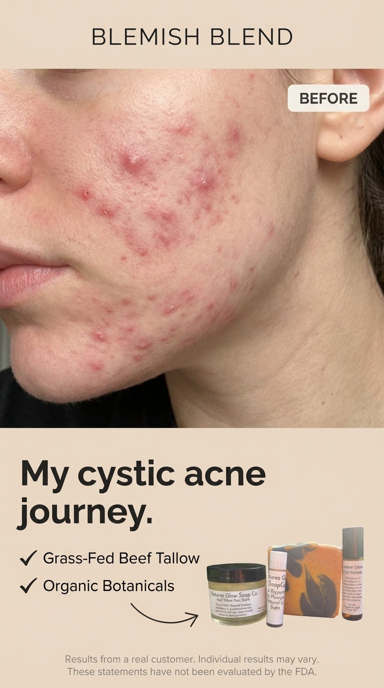 Blemish Blend Acne Away Natural Skincare Routine for acne prone and sensitive skin.